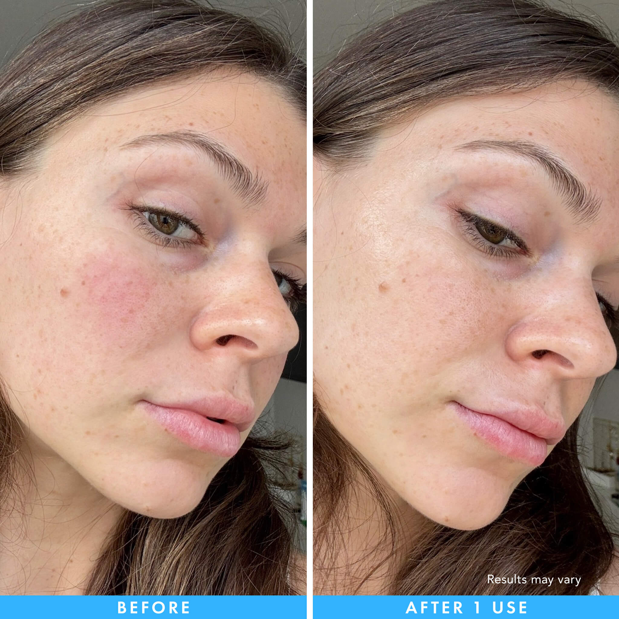 Cryo + Soothing Hydrogel Mask R1