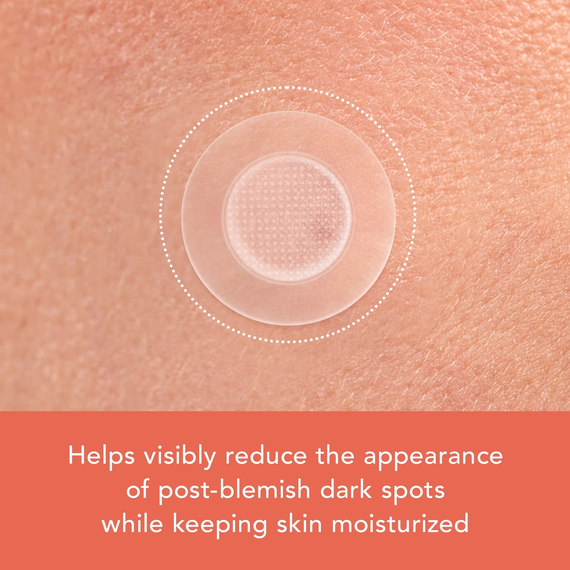 Miracle Patch Microcrystal Vitamin C Dark Spot Cover V8