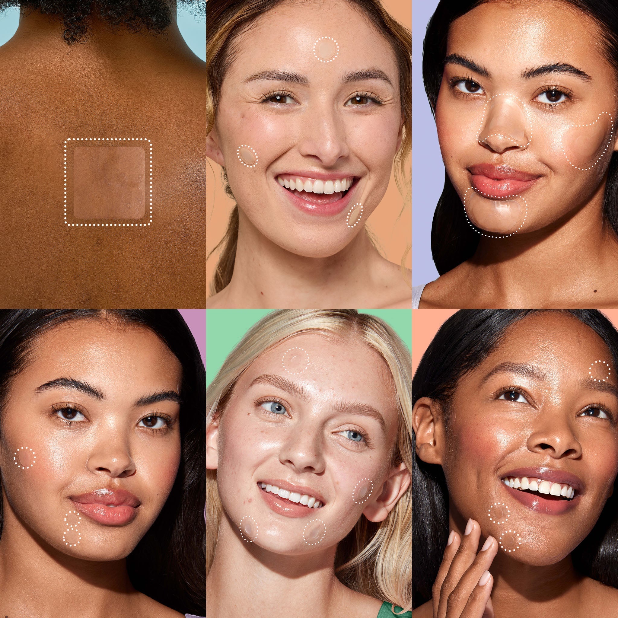 Miracle Patch Ultimate Blemish Patch Kit H5