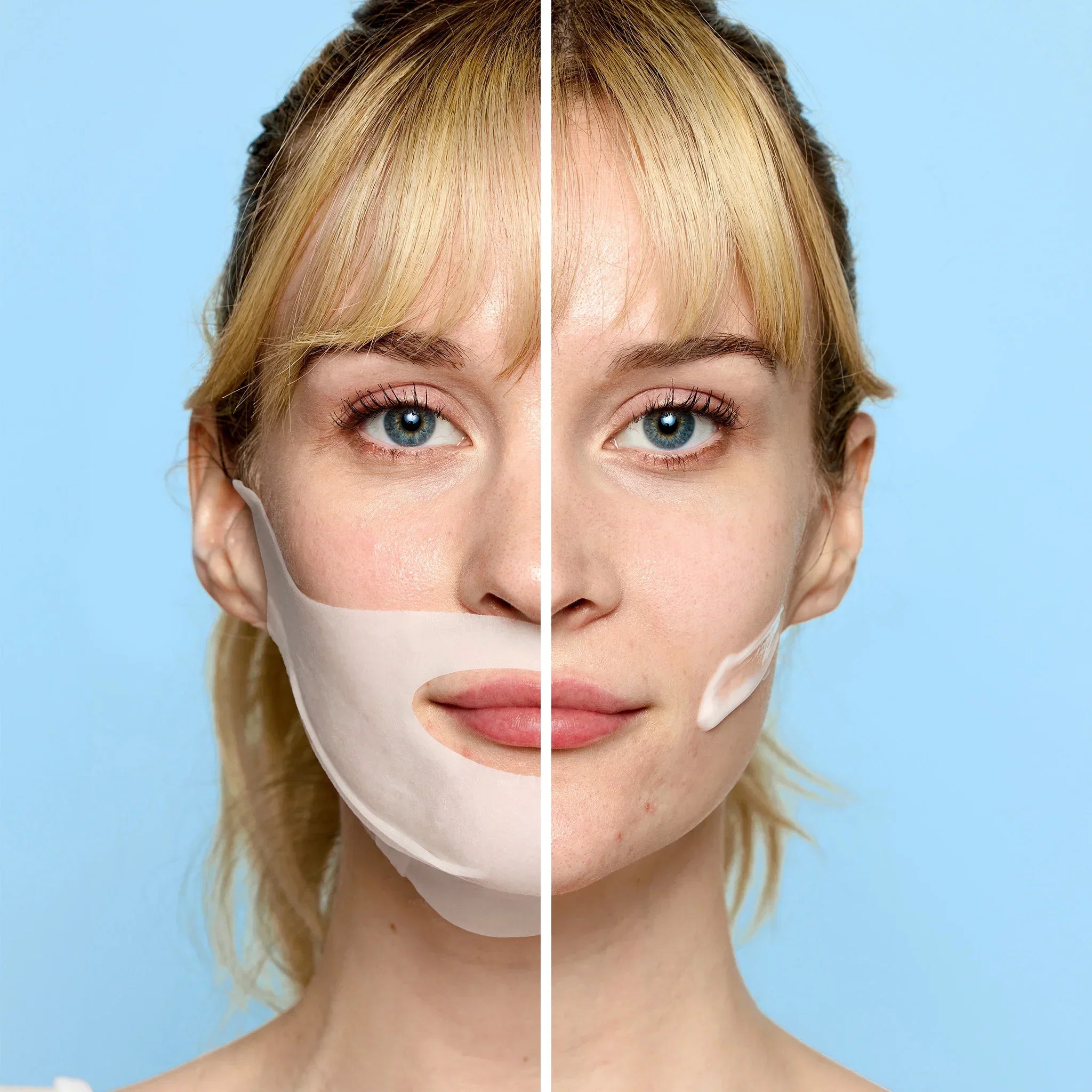 Blemish Control Bundle V0