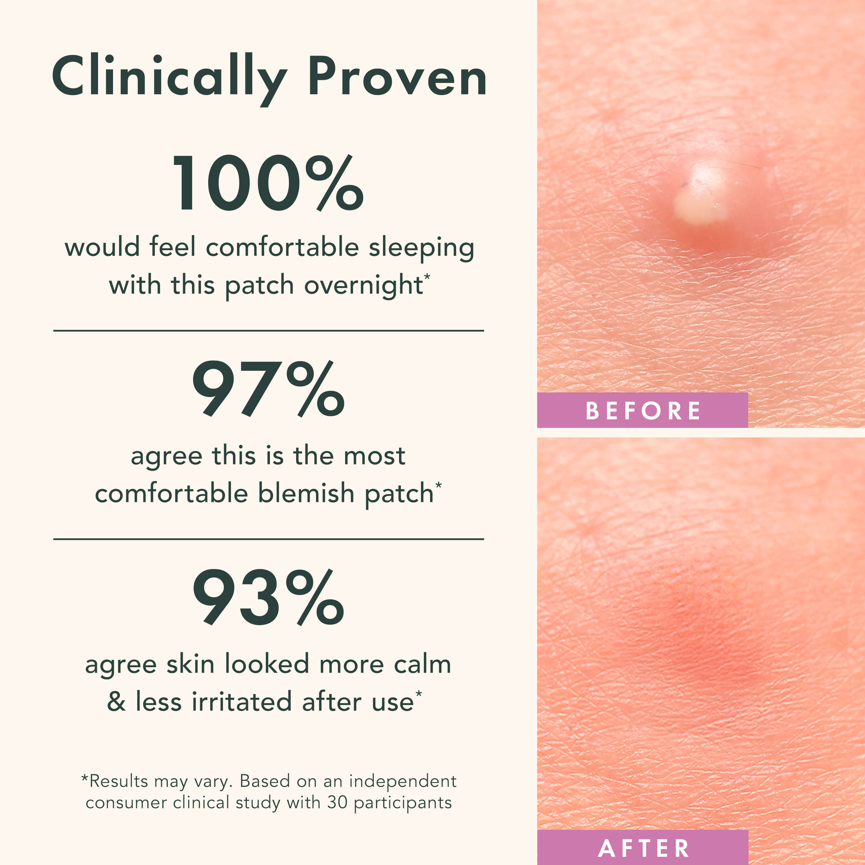 Miracle Patch Overnight Spot Cover X0