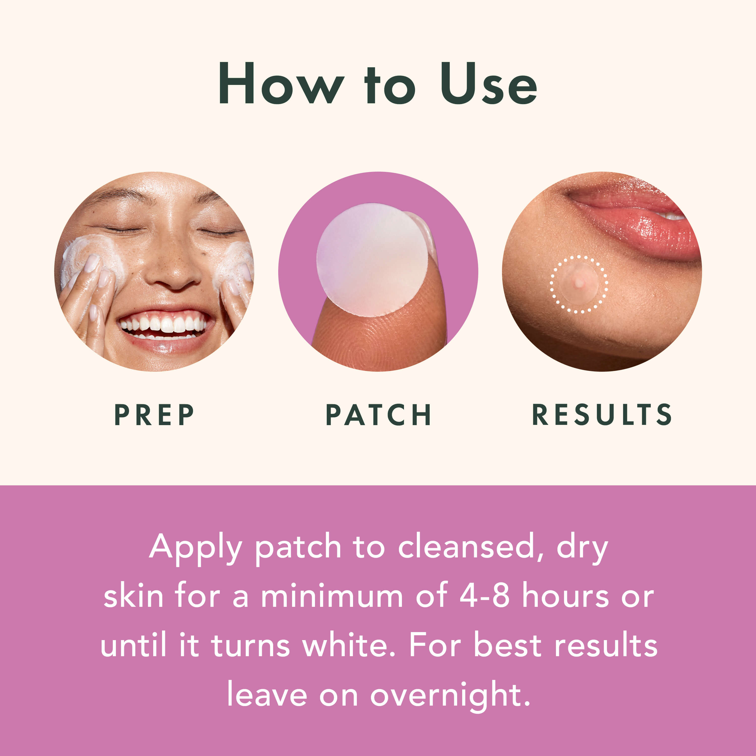 Miracle Patch Overnight Spot Cover X0